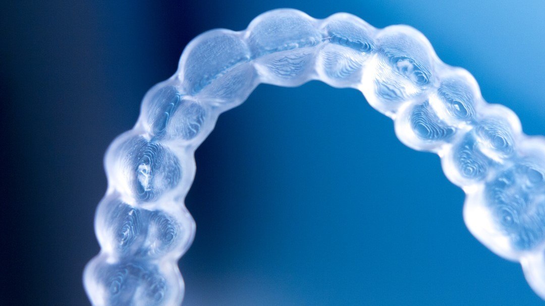 Orthodontics or Veneers Correct Misalignment On Front Teeth Smile