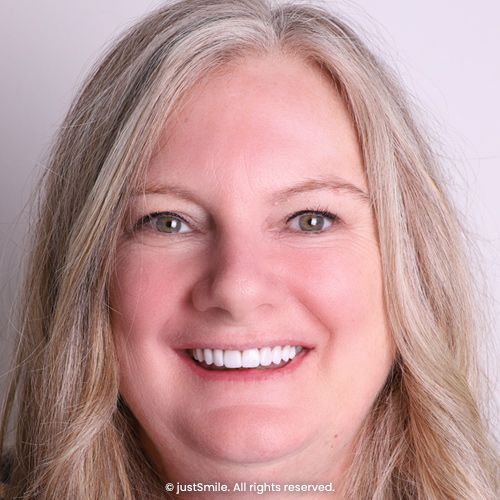 Smile Makeover Transformation for Crooked and Stained Teeth